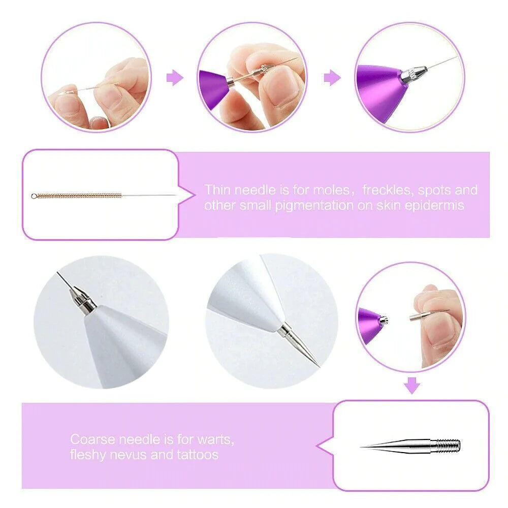 Professional Mole & Skin Tag Remover