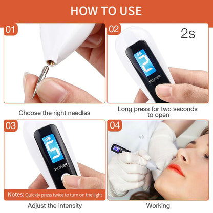 Professional Mole & Skin Tag Remover