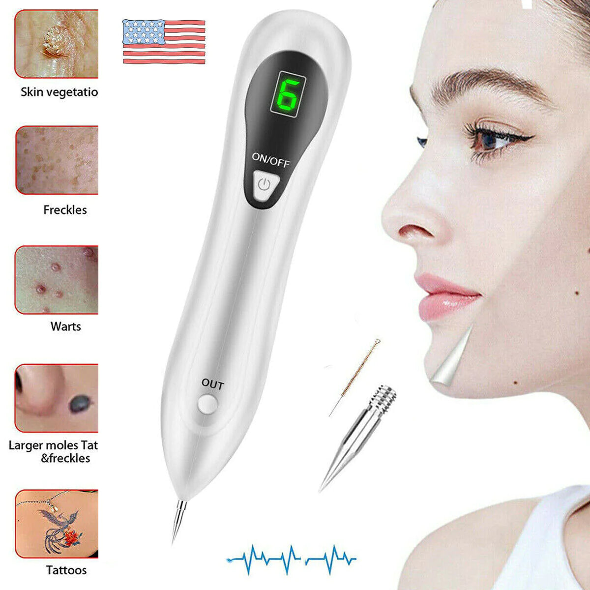 Professional Mole & Skin Tag Remover